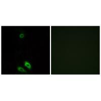 Rabbit Polyclonal Antibody to AKR1CL1