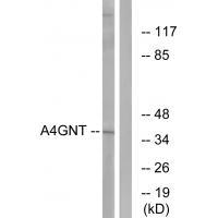 Rabbit Polyclonal Antibody to A4GNT
