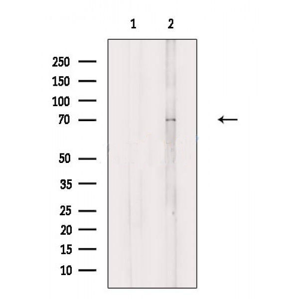 Rabbit Polyclonal Antibody to SCNN1D