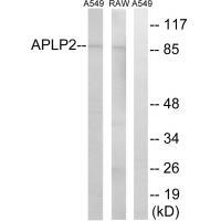Rabbit Polyclonal Antibody to APLP2