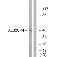 Rabbit Polyclonal Antibody to ALS2CR4