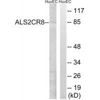 Rabbit Polyclonal Antibody to ALS2CR8