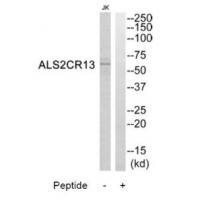 Rabbit Polyclonal Antibody to ALS2CR13