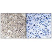 Rabbit Polyclonal Antibody to AMOTL1