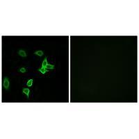 Rabbit Polyclonal Antibody to KANK2