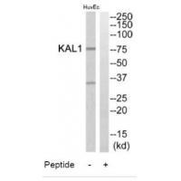 Rabbit Polyclonal Antibody to KAL1