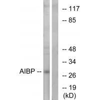 Rabbit Polyclonal Antibody to AIBP