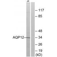 Rabbit Polyclonal Antibody to AQP12