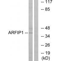 Rabbit Polyclonal Antibody to ARFIP1