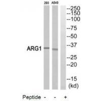 Rabbit Polyclonal Antibody to ARG1