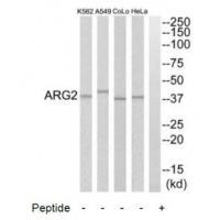 Rabbit Polyclonal Antibody to ARG2