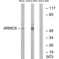 Rabbit Polyclonal Antibody to ARMC6
