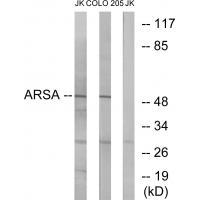 Rabbit Polyclonal Antibody to ARSA