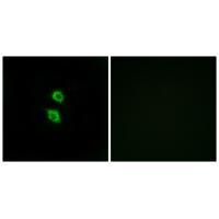 Rabbit Polyclonal Antibody to ARSD
