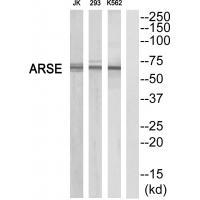 Rabbit Polyclonal Antibody to ARSE
