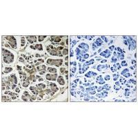 Rabbit Polyclonal Antibody to ATP5G2