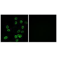 Rabbit Polyclonal Antibody to ATP5G3
