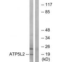 Rabbit Polyclonal Antibody to ATP5L2