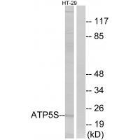 Rabbit Polyclonal Antibody to ATP5S