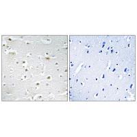 Rabbit Polyclonal Antibody to DDX3Y