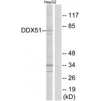 Rabbit Polyclonal Antibody to DDX51