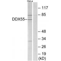 Rabbit Polyclonal Antibody to DDX55