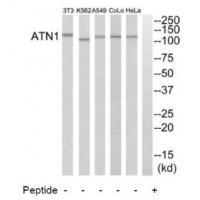 Rabbit Polyclonal Antibody to ATN1