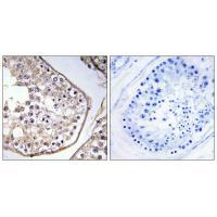Rabbit Polyclonal Antibody to BAGE3
