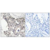 Rabbit Polyclonal Antibody to BAGE4
