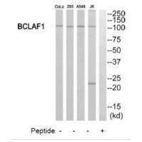 Rabbit Polyclonal Antibody to BCLAF1