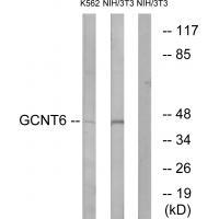 Rabbit Polyclonal Antibody to GCNT6