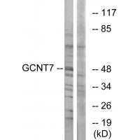 Rabbit Polyclonal Antibody to GCNT7