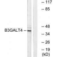 Rabbit Polyclonal Antibody to B3GALT4