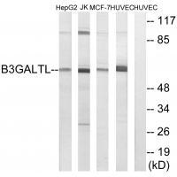 Rabbit Polyclonal Antibody to B3GALTL