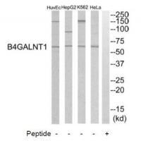 Rabbit Polyclonal Antibody to B4GALNT1