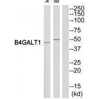 Rabbit Polyclonal Antibody to B4GALT1