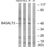 Rabbit Polyclonal Antibody to B4GALT3