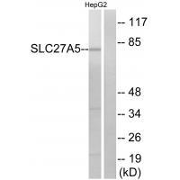 Rabbit Polyclonal Antibody to SLC27A5