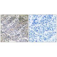 Rabbit Polyclonal Antibody to BRP44