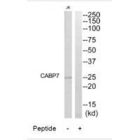 Rabbit Polyclonal Antibody to CABP7