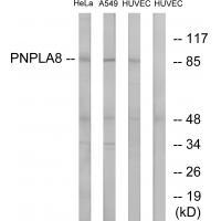 Rabbit Polyclonal Antibody to PNPLA8
