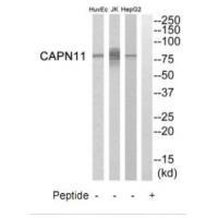 Rabbit Polyclonal Antibody to CAPN11