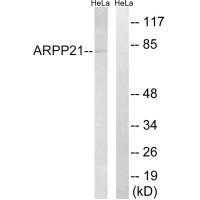 Rabbit Polyclonal Antibody to ARPP21