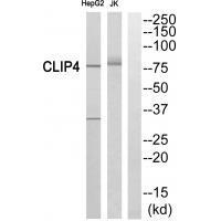Rabbit Polyclonal Antibody to CLIP4