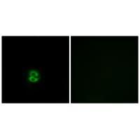 Rabbit Polyclonal Antibody to CHST6