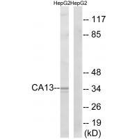 Rabbit Polyclonal Antibody to CA13