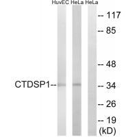 Rabbit Polyclonal Antibody to CTDSP1
