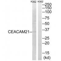 Rabbit Polyclonal Antibody to CEACAM21