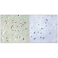 Rabbit Polyclonal Antibody to CNTROB