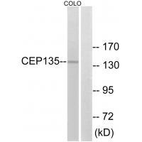 Rabbit Polyclonal Antibody to CEP135